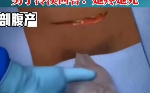 女子剖腹产后遭老公大骂3小时（女子剖腹产后遭老公大骂3小时）