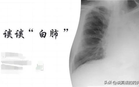 新冠白肺有什么症状（新冠白肺症状）