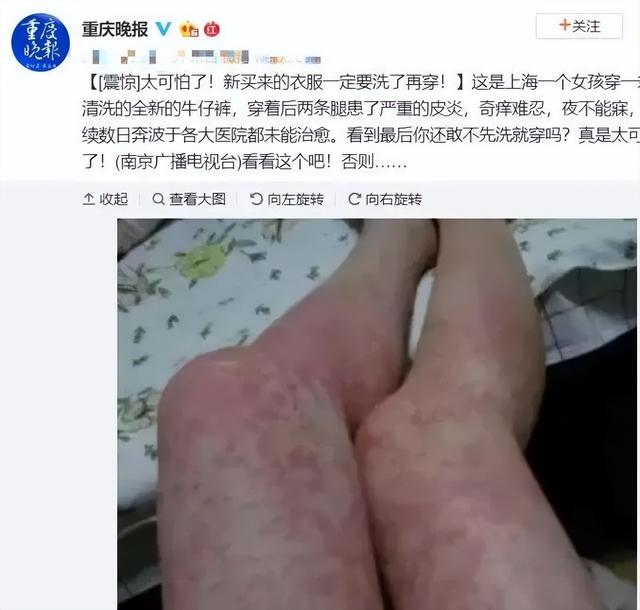 毒物超标27倍的“衣服”曝光：这是人干的事吗(组图)