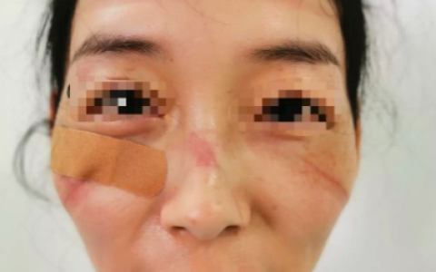大坪医院皮肤科怎么样，大坪医院皮肤科怎么样挂号
