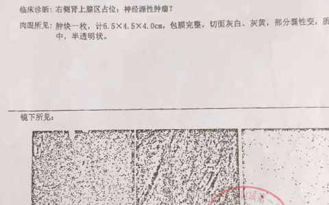无锡太平洋保险怎么样，太平洋保险恶性肿瘤理赔标准
