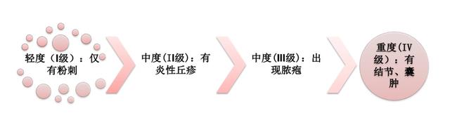 那么多祛痘膏产品，究竟哪个适合你？