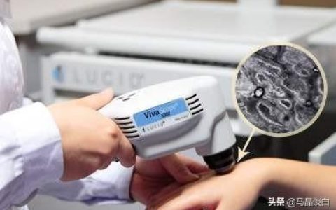 怎么样治白癫好，你也是这样治疗白癜风的？难怪治不好