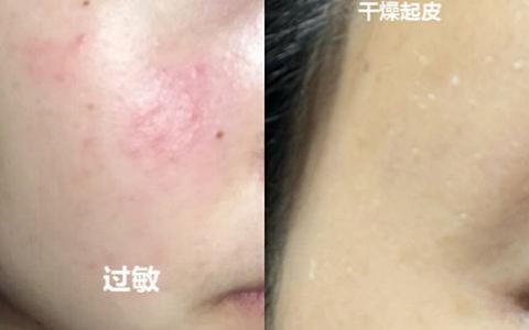 可芳的产品怎么样，可芳的产品怎么样好用吗