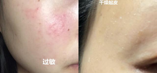 公认好用的4款孕妇保湿水乳：悦木之源，芙丽丝芳均上榜，你的呢