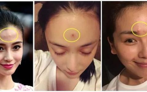 乐敦祛痘印膏怎么样，去痘痘祛痘印产品推荐